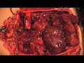 VFX - cutting open someones stomach