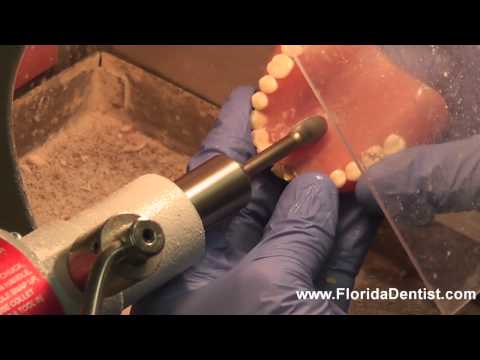 how to repair broken dentures