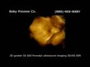 Baby Preview.mov Baby Preview.mov