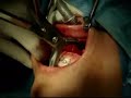 Cirurgia Ortognatica Cirurgia Ortognatica