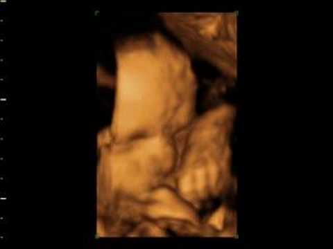 simon scans