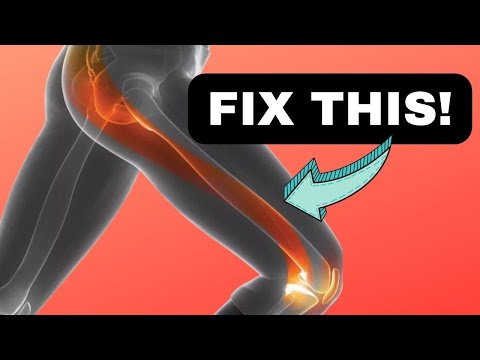 how to treat iliotibial band syndrome