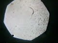 CULTIVO STRONGILOIDES