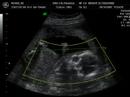Nosek baby ultrasound
