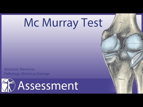 how to perform mcmurray test