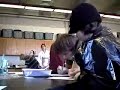 clival-chordoma-rare-tumour-brain-surgery.html