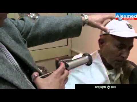 External Ear Disease - Wax Impaction