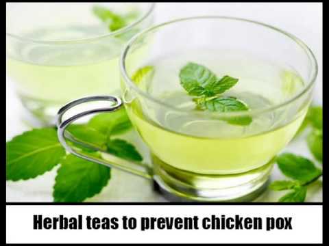 how to treat chicken pox