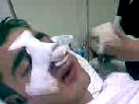 Septum Deviasyonu Ameliyat� Videosu �zle