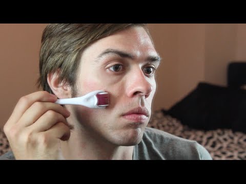 how to use a acne needle