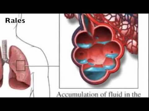 how to assess lung sounds