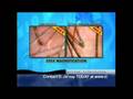 videos de Thinning Hair in Delaware.m4v
