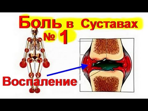 Как снять боль и восстановить суставы Как снять боль и восстановить суставы