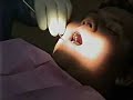 Hipnose - Extração de Dente Hipnose - Extração de Dente