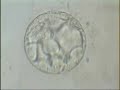 Blastocyst 1