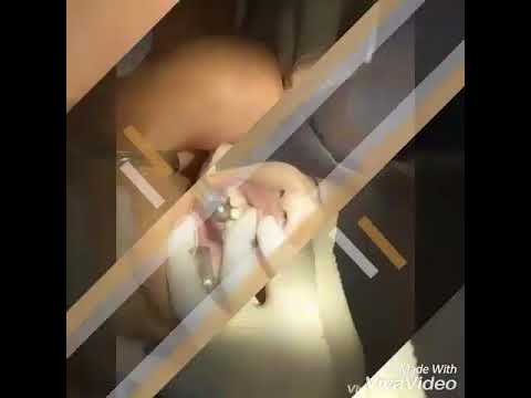 Quy Trình Phục Hình Răng Sứ Thẩm Mỹ