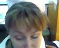 Ophthalmology Practice (ant.chamber iris 2 )