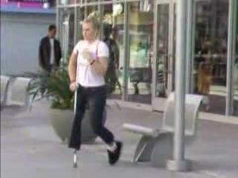 britney amputee