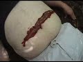 Sound of Urchin-Dracula Bite