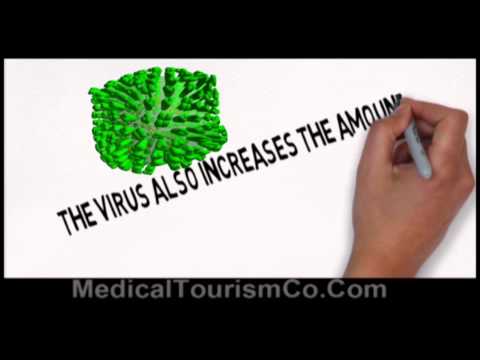 how to avoid obesity