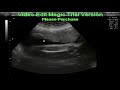 4d-ultrahang-ultrasound-m-b-k.html