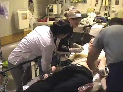 how to assess for stroke