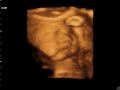 BABY OLIVER 18