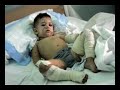 La Guerra dei Bambini - PAPPAGALLI VERDI