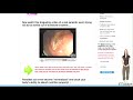 stomach fat loss tips