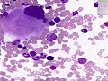 Histología - Frotis de médula ósea Histología - Frotis de médula ósea