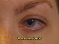 EMDR EMDR