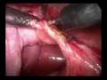 Cirurgia parte1