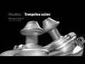 ResMed - Sleep Apnea
