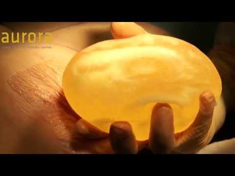 how to detect silicone implant leak