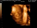 Mini Noe 25 semanas