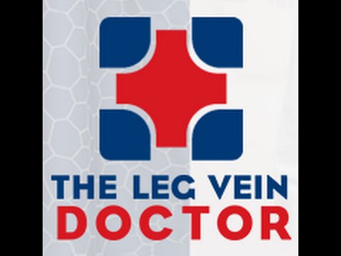 how to help varicose veins