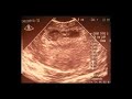 My Little Secret