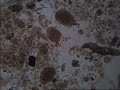 Tardigrade dance Tardigrade dance