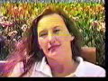 amputee dusty 1