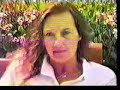 amputee dusty 1