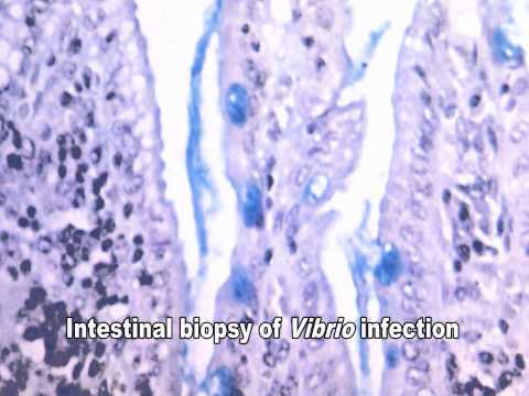 how to isolate vibrio cholerae