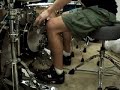 Bostic-Flat Foot Technique