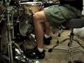 Bostic-Flat Foot Technique