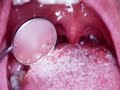 Examen Bucal en Odontologia UANCV Examen Bucal en Odontologia UANCV