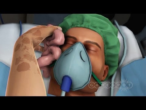 gamespot - Hammering open ribcages, sawing apart guts, and throwing organs around are all part of a normal day's work in Surgeon Simulator 2013. Subscribe for more Rand...