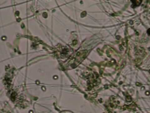Microscopic View of 5 uL Pond Water