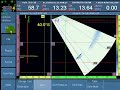Click here to watch this video OMNISCAN PAUT TRAINING