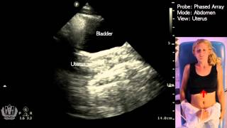 Basic Evaluation of Pelvic Anatomy (Female) using 