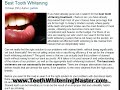 Even if you don't have any kind of teeth whitening challenge - this will be relevant to see. http://ping.fm/iN4B2