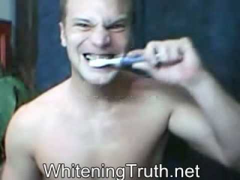 how to whiten super yellow teeth